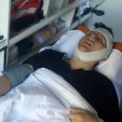 Ermal Mamaqi, Shtrihet Në Spital Për 1 Prillin